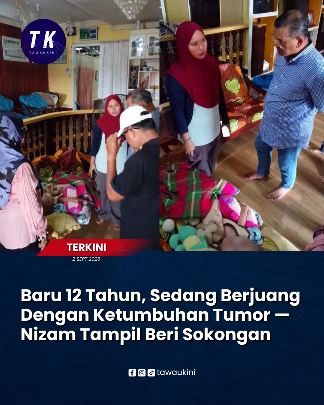 Prihatin Nasib Kanak-Kanak 12 Tahun Hidap Neurofibromatosis, Nizam Abu Bakar Titingan Ziarah Keluarga Di Tawau